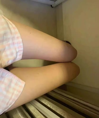 Photo cliente jambes résultats épilation lumière pulsée lumeor pulse pro